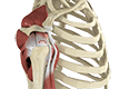 Rotator Cuff Tear